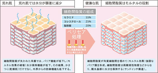 ペリセール
